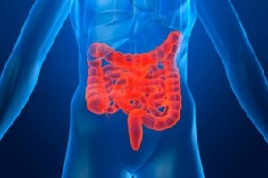 ¿Cuál es el tratamiento alternativo de la Enfermedad de Crohn?, por la Dra. Elena Bejarano