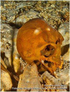 cráneo humano