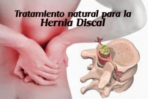 Tratamiento y prevención para la hernia discal
