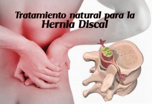 hernia-discal-web-1024x817