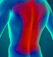 ¿Cómo acabar con el dolor de espalda con homeopatía?