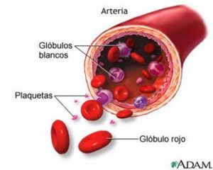 anemia ferropenica
