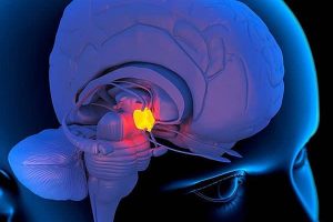 ¿Qué es el quiste en la glándula pineal?: Causas, síntomas, diagnóstico