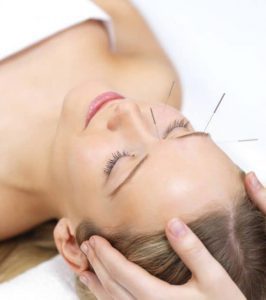 hermandadblanca acupuntura facial 550×620.jpg - Beneficios de la acupuntura - hermandadblanca.org